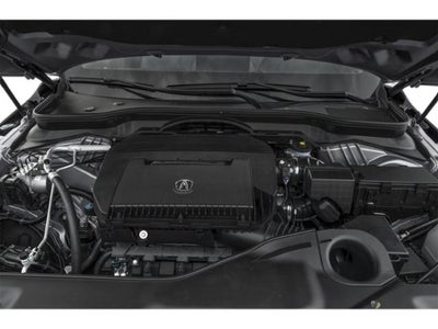 2025 Acura MDX Technology Package
